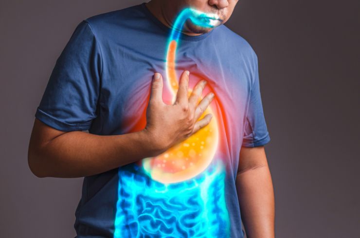 Gastroesophageal Reflux Disease